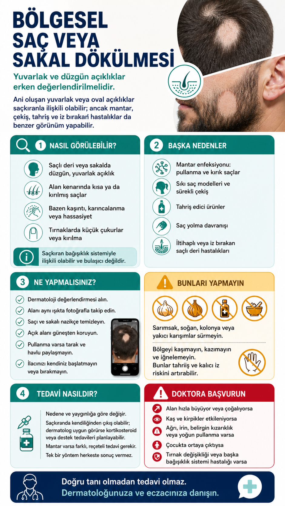 Bölgesel saç ve sakal dökülmesinin nedenleri, yapılmaması gerekenler ve doktora başvuru işaretlerini anlatan Eczacı Notları infografiği